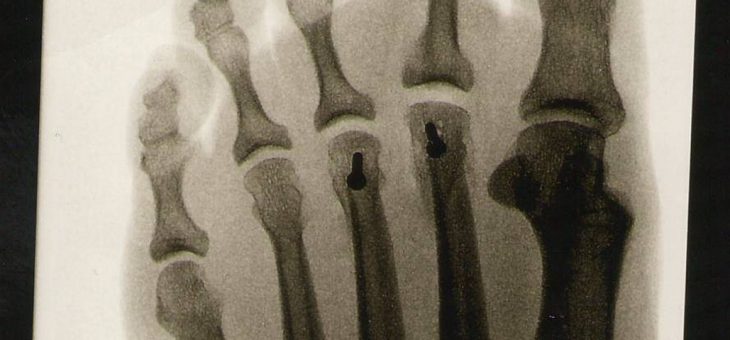 Activităţi cu preşcolari – Anatomia